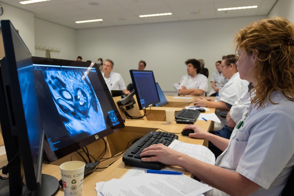 Artsen in witte jassen bekijken hersenscans van teruggekeerde endeldarmkanker op computers in een vergaderruimte.