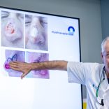 AI helpt jou kiezen na een huidkankeroperatie in je gezicht
