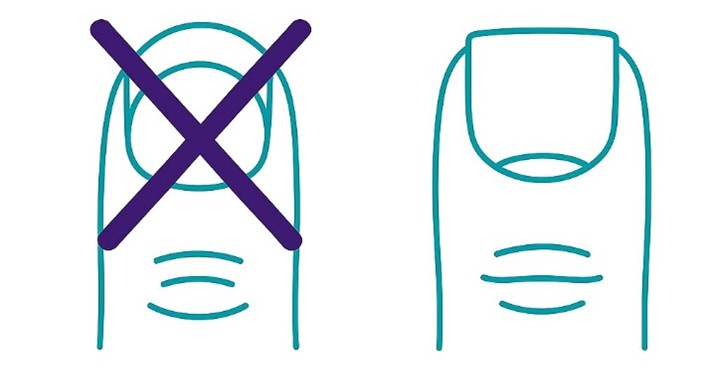 Twee simpele nagelillustraties: links een paarse X, rechts leeg; tonen verschillende knipvormen voor diabetische voet.