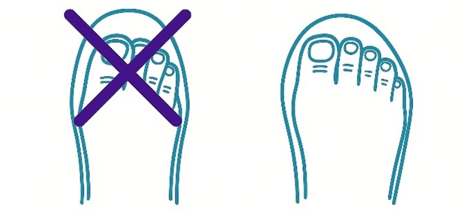Twee lijntekeningen van voeten: linker voet met paarse X, rechter voet zonder markering. Tenen en benen zichtbaar.