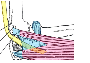 Anatomisch diagram van de elleboog met spieren, pezen en zenuwen bij ulnaris neuropathie, onderdelen gelabeld.