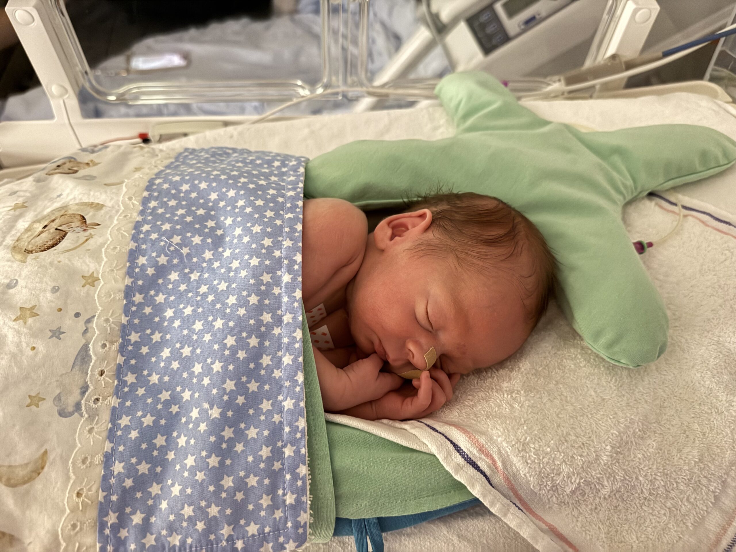 Baby met sondevoeding