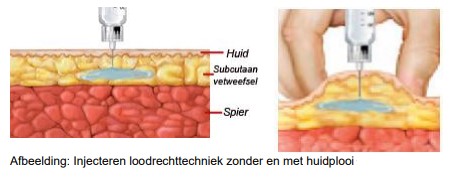 Twee schema's: subcutane injectie met en zonder huidplooi, met labels voor huid, dierenarts en spier.
