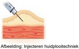 Naald bij huidplooitechniek voor subcutane injectie; huid is opgepakt, klaar om te prikken.
